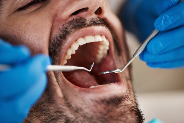 Best Laser Dentistry  in Grill, PA